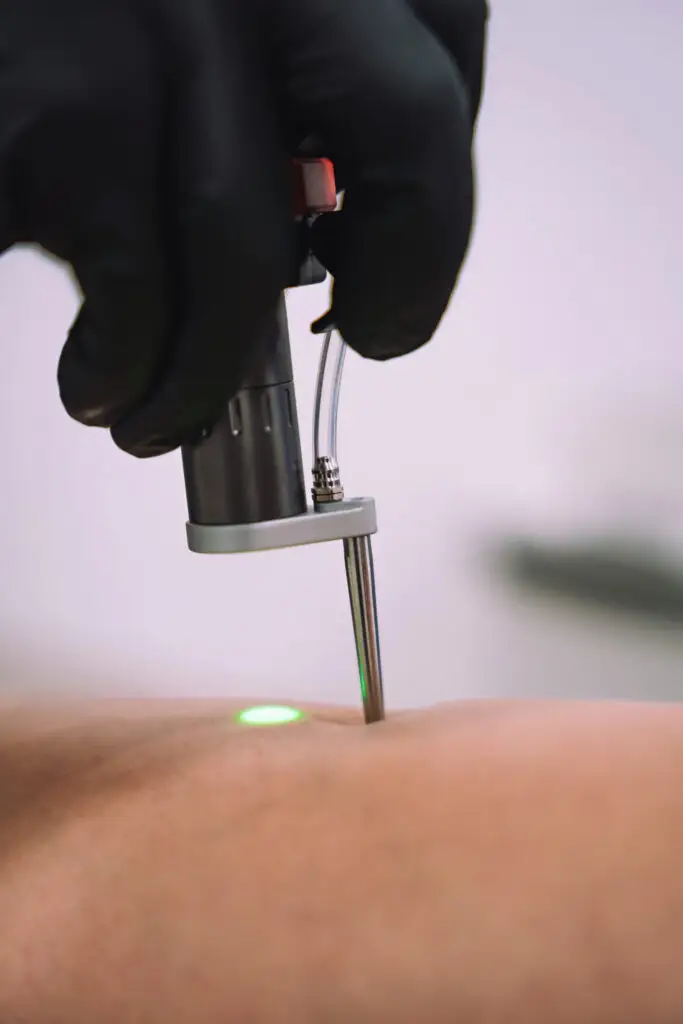 Close up shot of gloved hand with the laser hair removal machine's handpiece along woman hand. Alexandrite laser techhnology removing hair. Beauty procedure