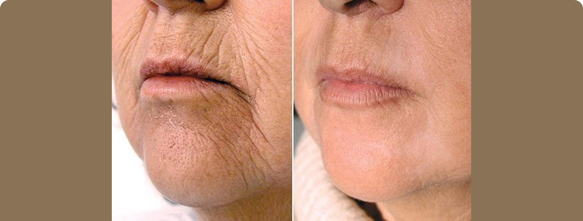 Before and After 3